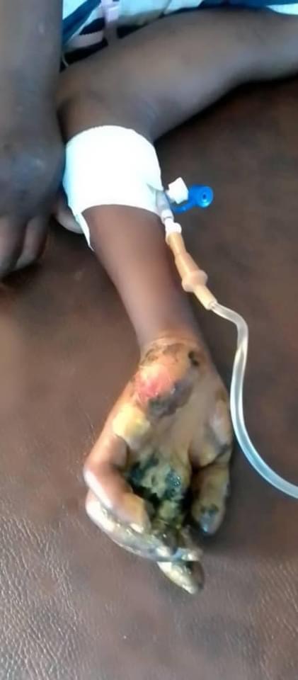 Uganda: Woman tortures her 4-year-old daughter over stealing meat